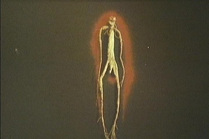 wdr14hzpmsy.jpg